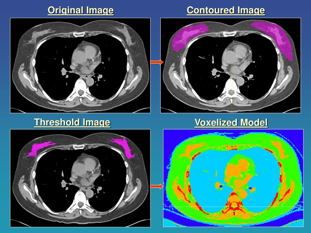 PPT CT Organ Dose Part 1 Estimating organ dose for patients