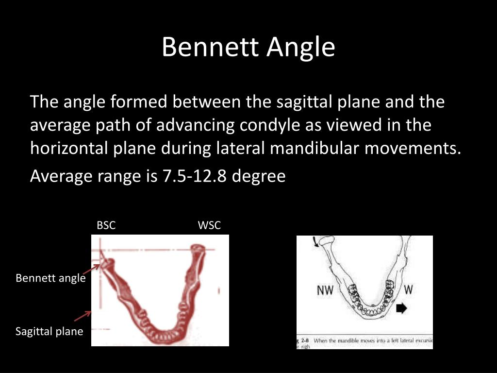 PPT Fundamentals Of Occlusion PowerPoint Presentation, free download