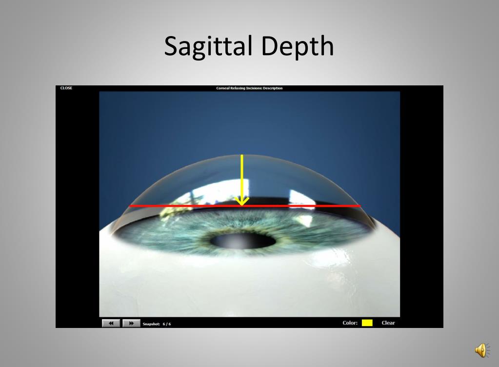 PPT Fitting the New Gas Perm Contacts PowerPoint Presentation, free