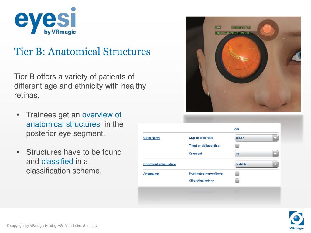 PPT Indirect Ophthalmoscope Simulator PowerPoint Presentation, free