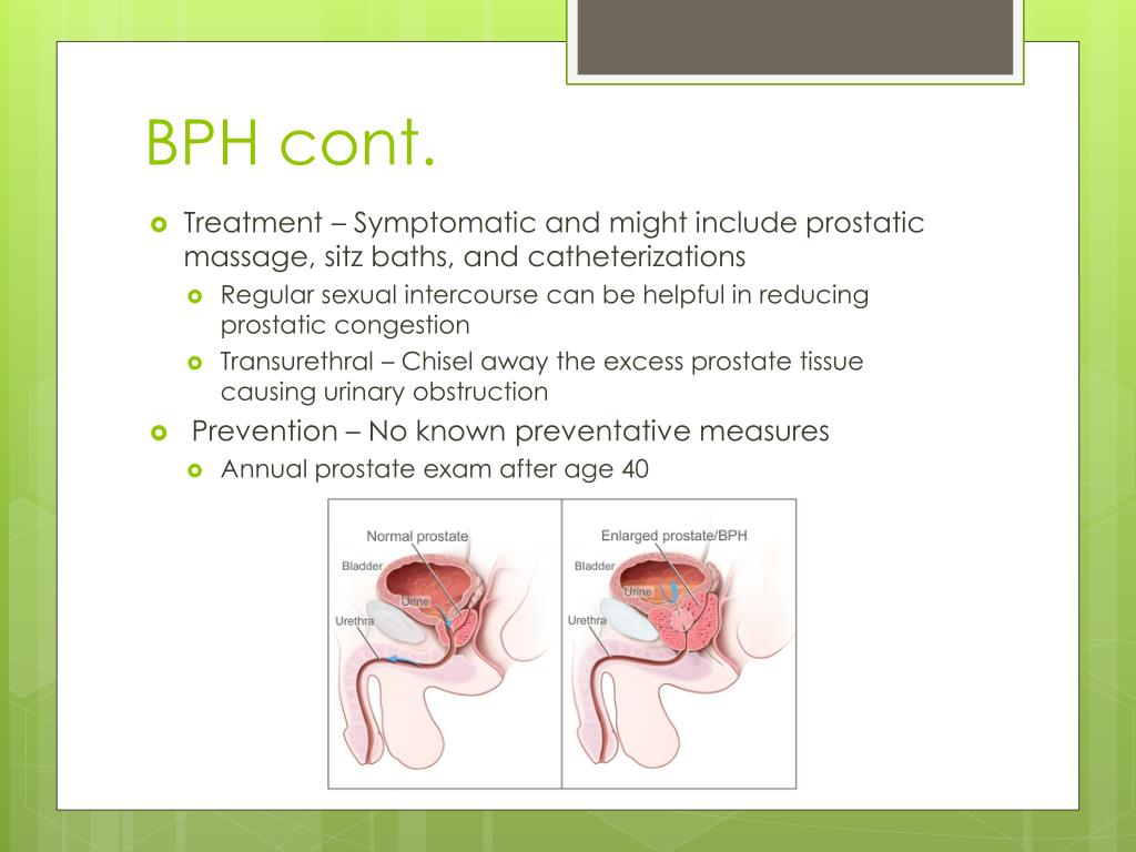 PPT Reproductive System Diseases and Disorders PowerPoint