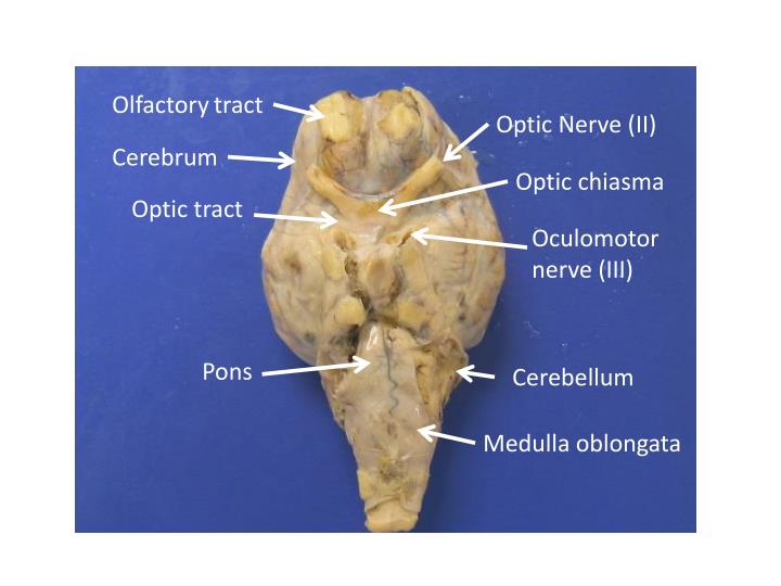 PPT Lab 12 Sheep Brain Dissection PowerPoint Presentation ID2162022