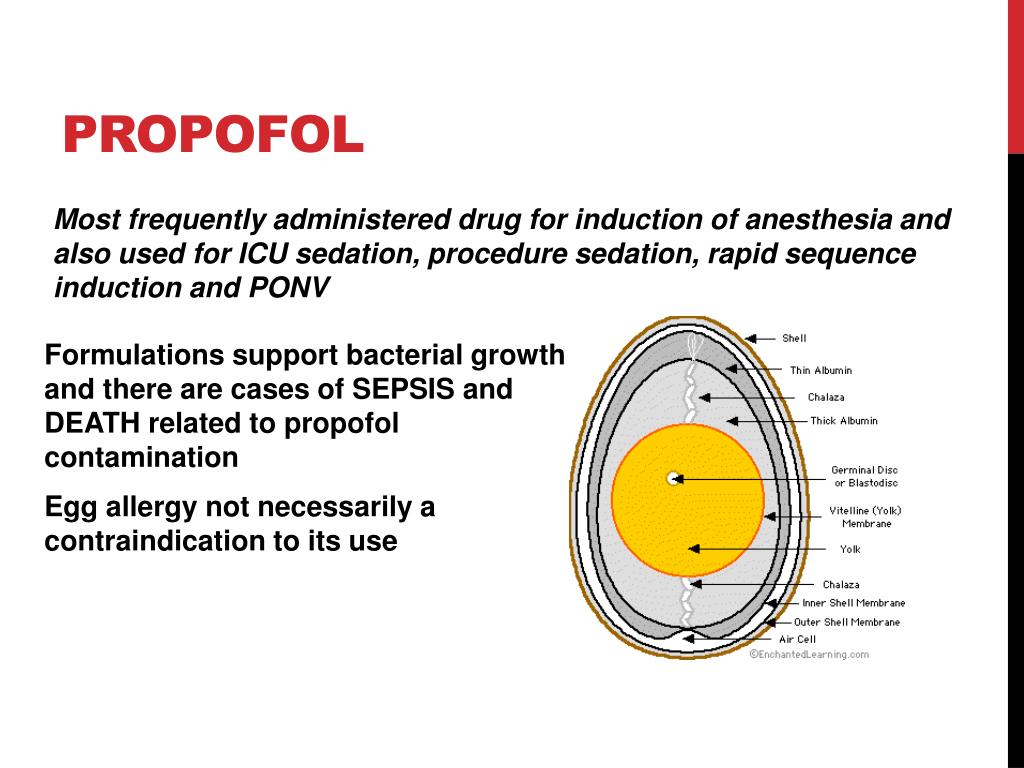 PPT Nonvolatile anesthetics PowerPoint Presentation, free download