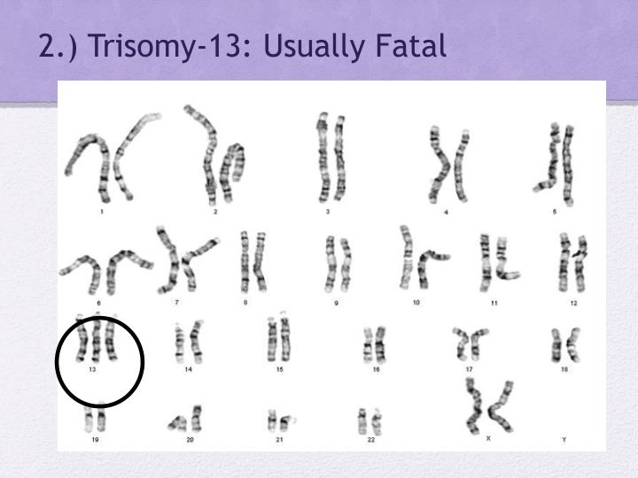 PPT KARYOTYPE AND DISORDERS PowerPoint Presentation ID2170996