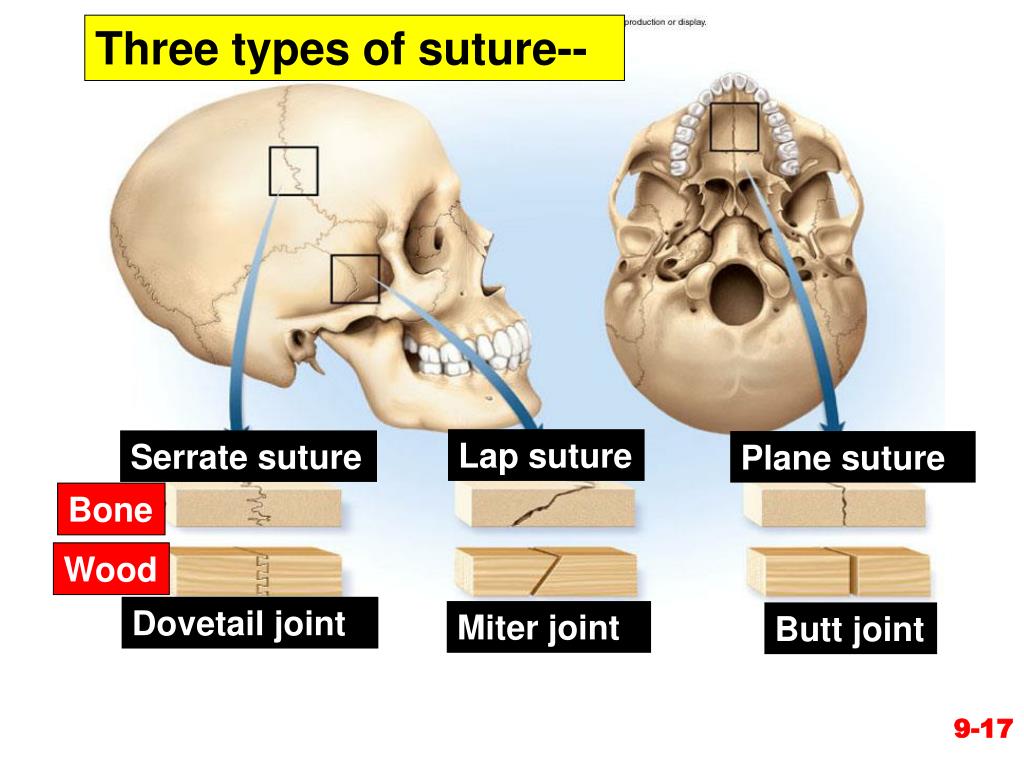 PPT Chapter 9 Joints PowerPoint Presentation, free download ID