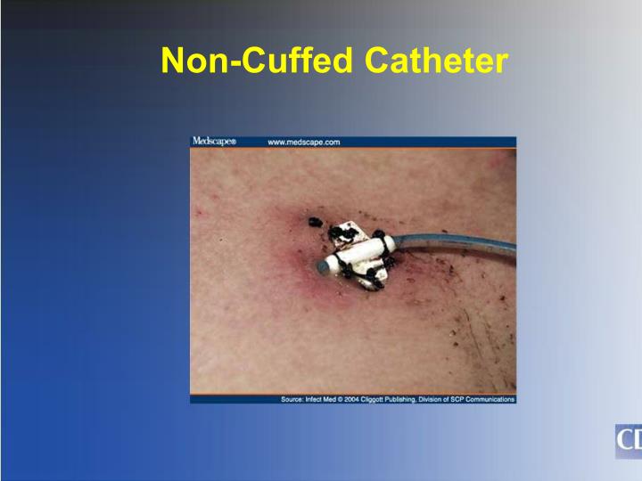 PPT Infection Control in Dialysis Access PowerPoint Presentation ID