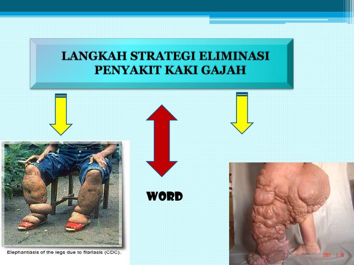 PPT DINAS KESEHATAN KABUPATEN PASAMAN BARAT PROGRAM PENANGGULANGAN