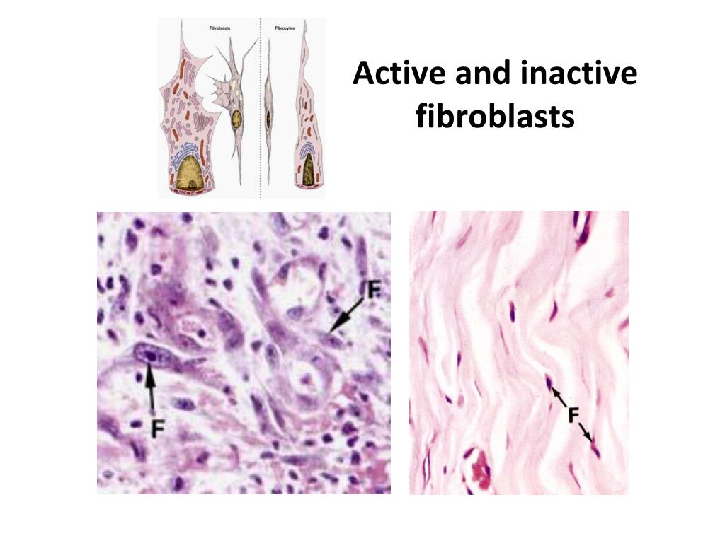 PPT Histology Connective Tissue PowerPoint Presentation, free