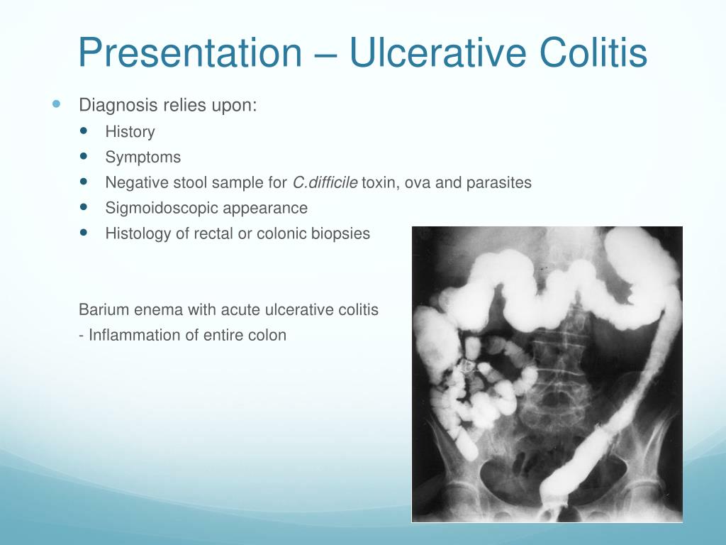 PPT IBD PowerPoint Presentation, free download ID2188057