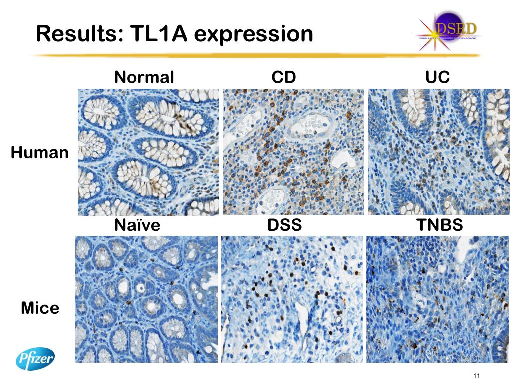 PPT TL1A Expression in Human IBD and Animal Models PowerPoint