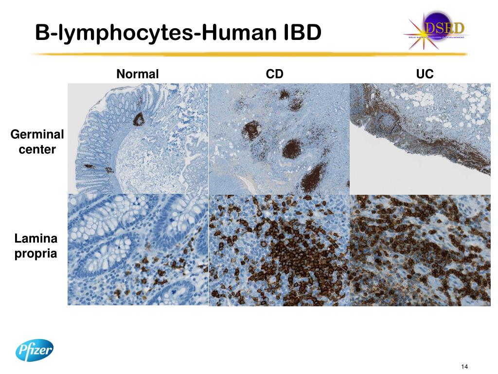 PPT TL1A Expression in Human IBD and Animal Models PowerPoint
