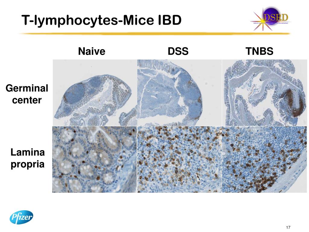 PPT TL1A Expression in Human IBD and Animal Models PowerPoint