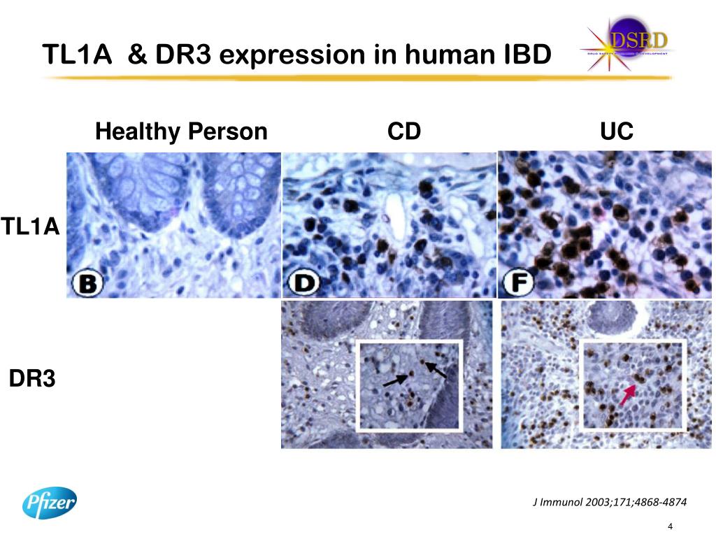 PPT TL1A Expression in Human IBD and Animal Models PowerPoint