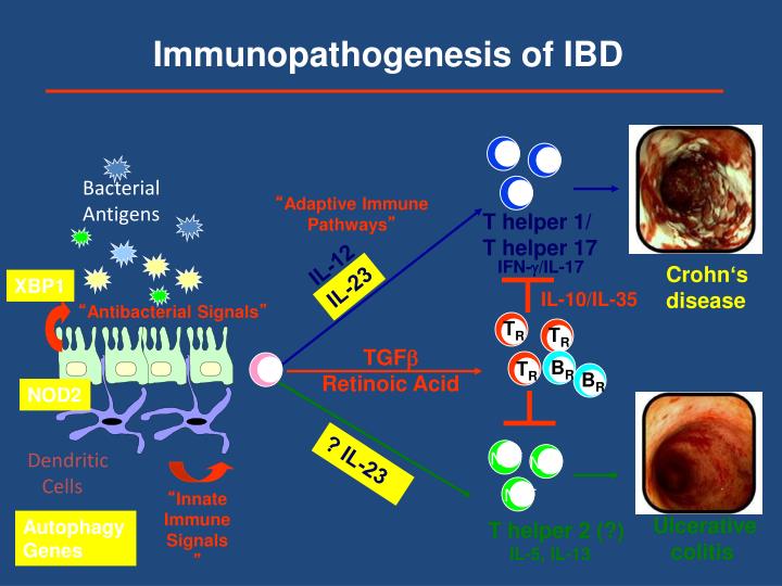 PPT Emerging treatments in Crohn’s disease and ulcerative colitis PowerPoint Presentation ID