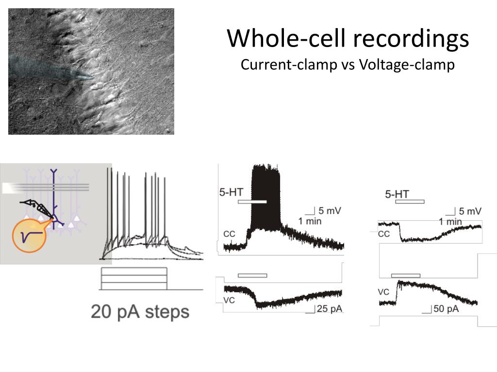 PPT Tweak Your Technique Electrophysiology 101
