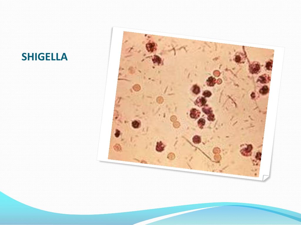 PPT STOOL EXAMINATION PowerPoint Presentation, free