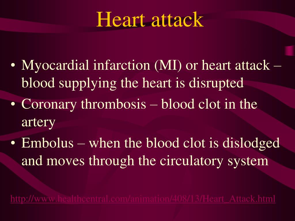 PPT CVD statistics PowerPoint Presentation, free download ID2225410