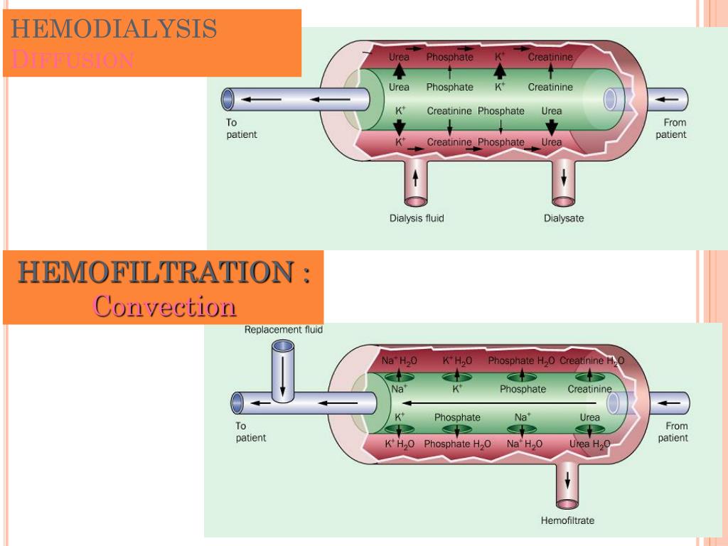 PPT Advances in dialysis technology PowerPoint Presentation, free