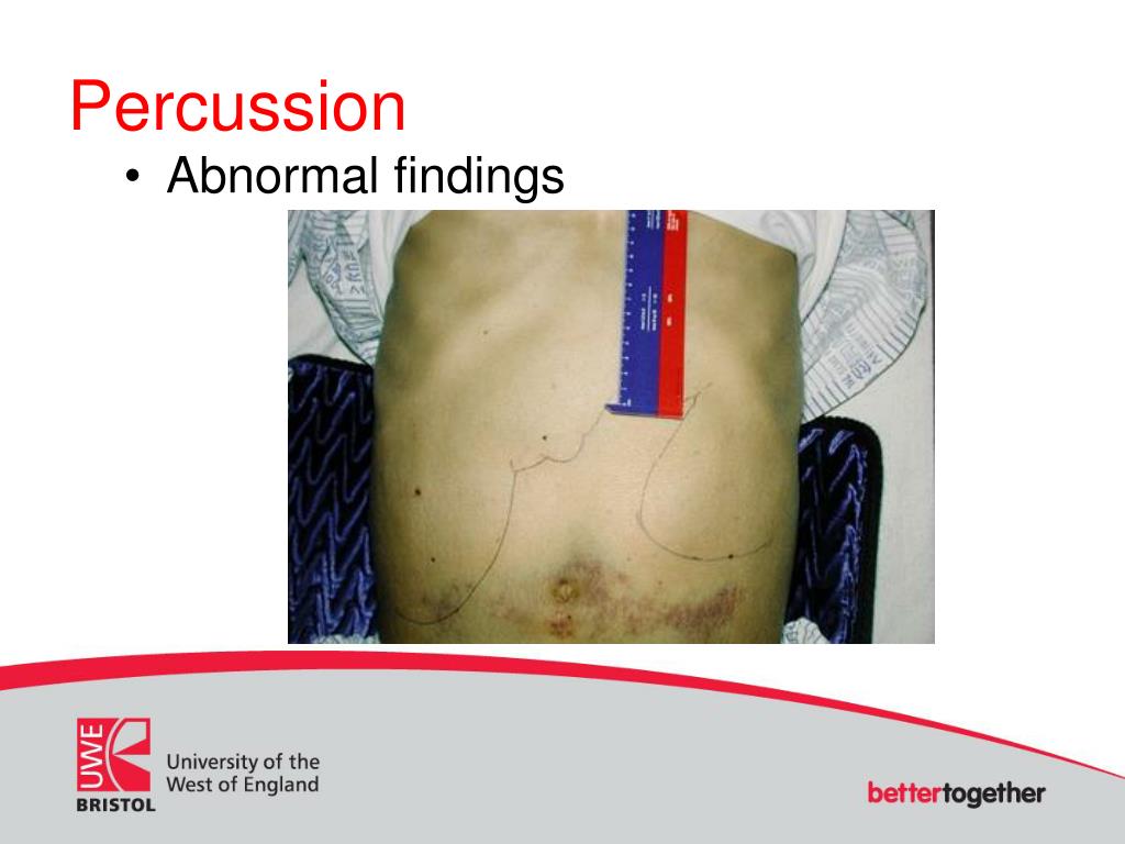 PPT Abdominal Exam for Advanced Practice PowerPoint Presentation