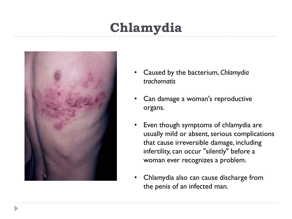 PPT S exually T ransmitted D iseases (Class 1) PowerPoint