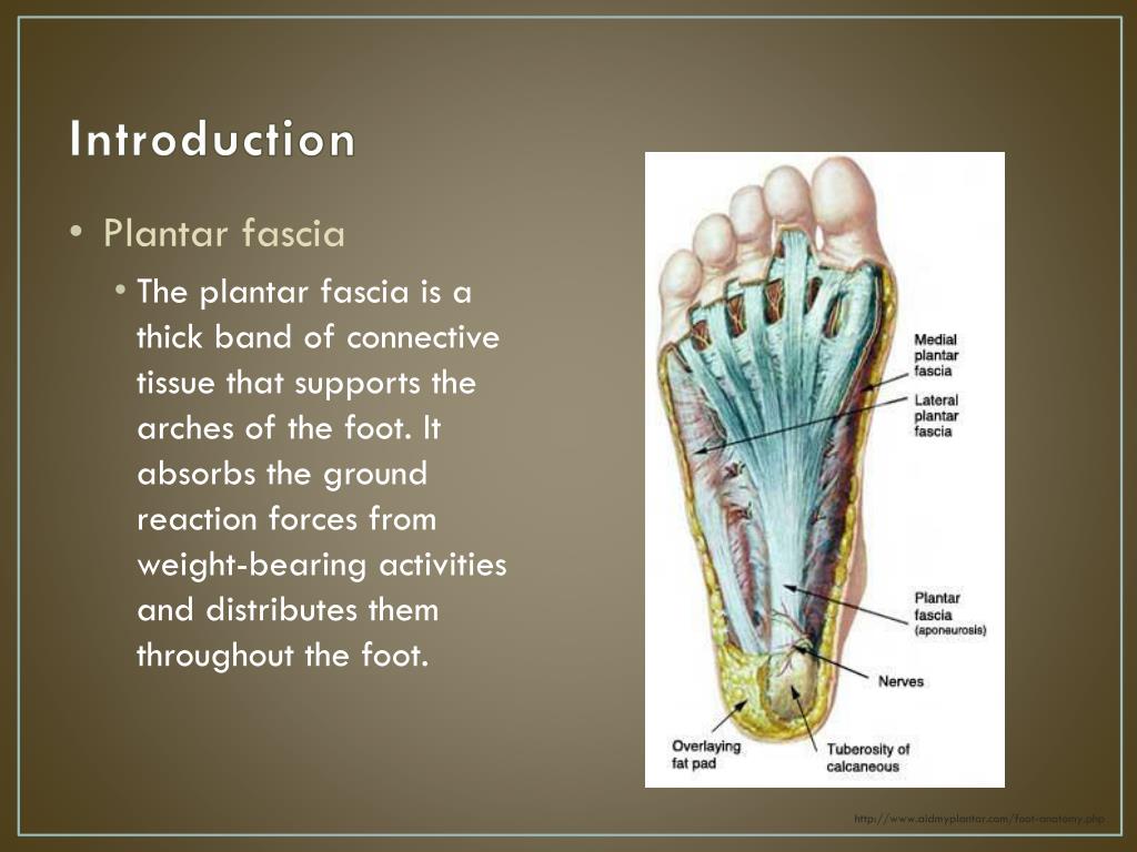 PPT Plantar Fasciitis Algorithm PowerPoint Presentation, free