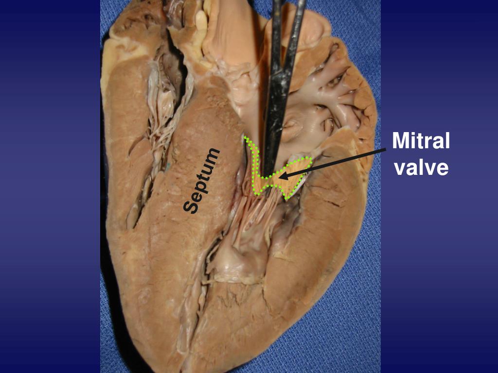 PPT Pig Heart Dissection PowerPoint Presentation, free download ID