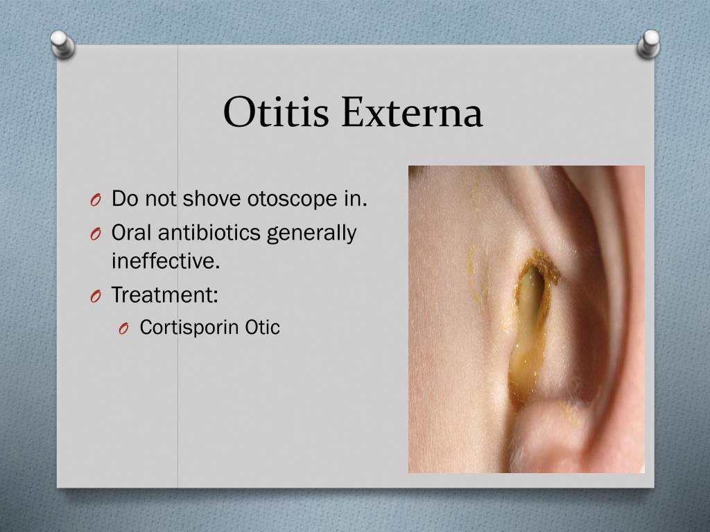 PPT Ear we go! PowerPoint Presentation, free download ID2258402