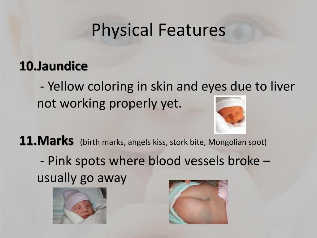 PPT NEONATE PowerPoint Presentation, free download ID2264187