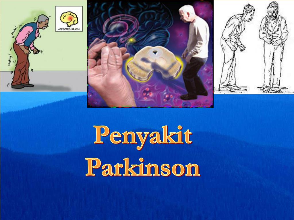 PPT Penyakit Parkinson PowerPoint Presentation, free download ID