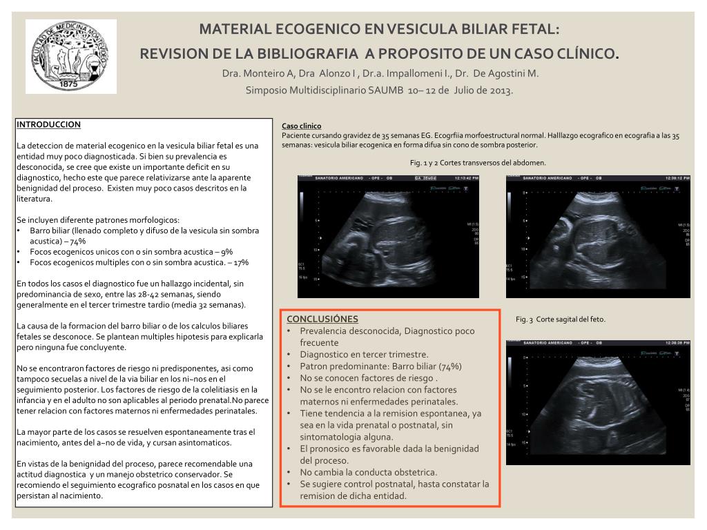 PPT MATERIAL ECOGENICO EN VESICULA BILIAR FETAL PowerPoint