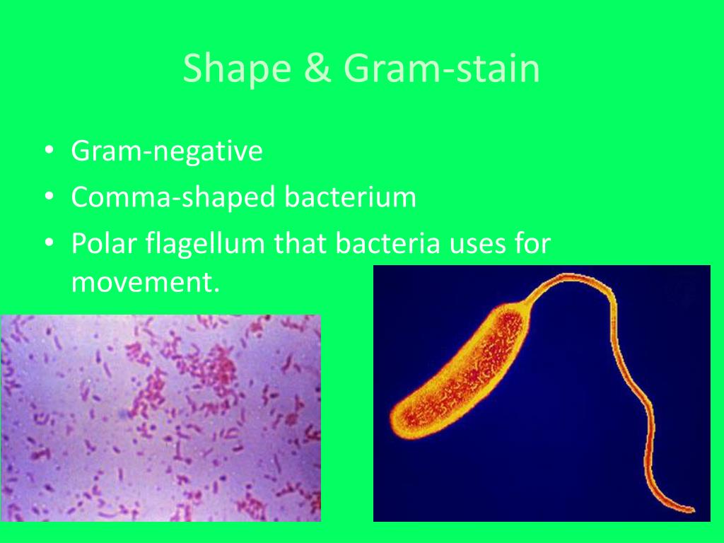 PPT Vibrio Cholerae PowerPoint Presentation, free