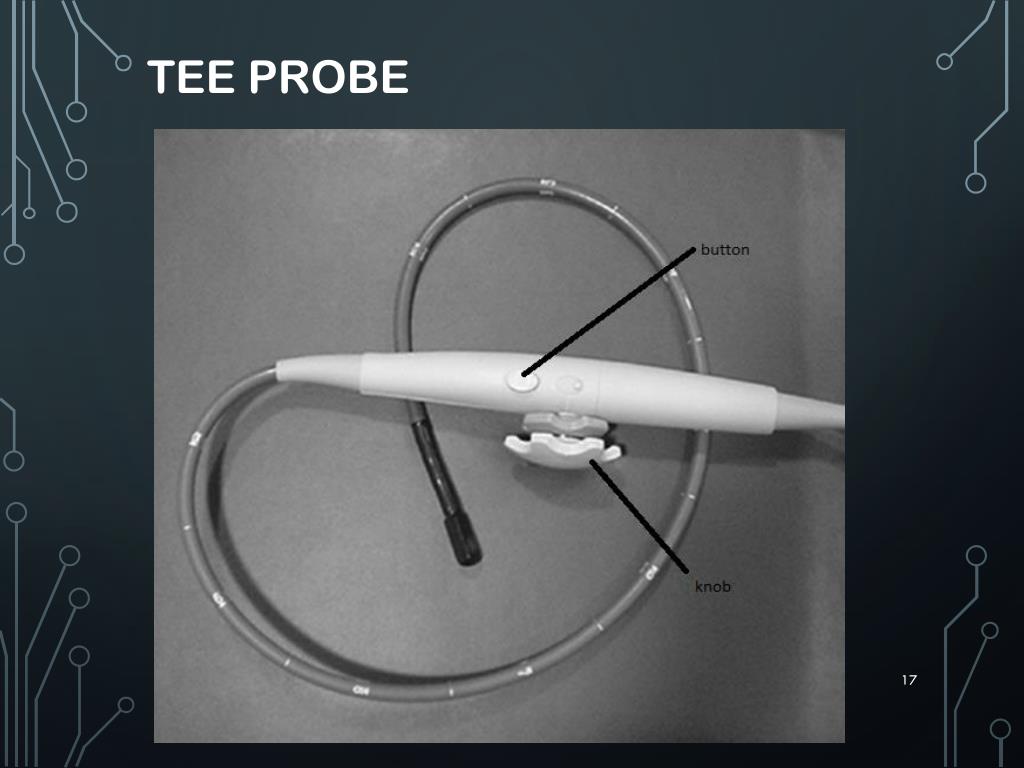 PPT Transesophageal & Intracardiac Echocardiography PowerPoint