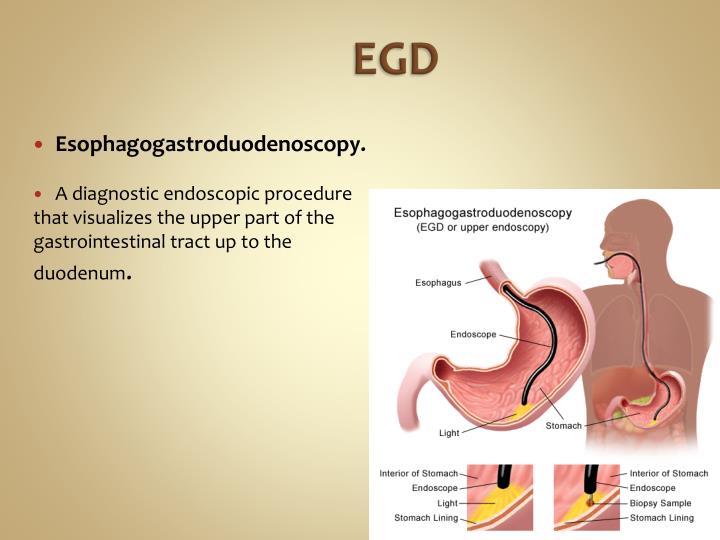 PPT General Procedures PowerPoint Presentation ID2277339