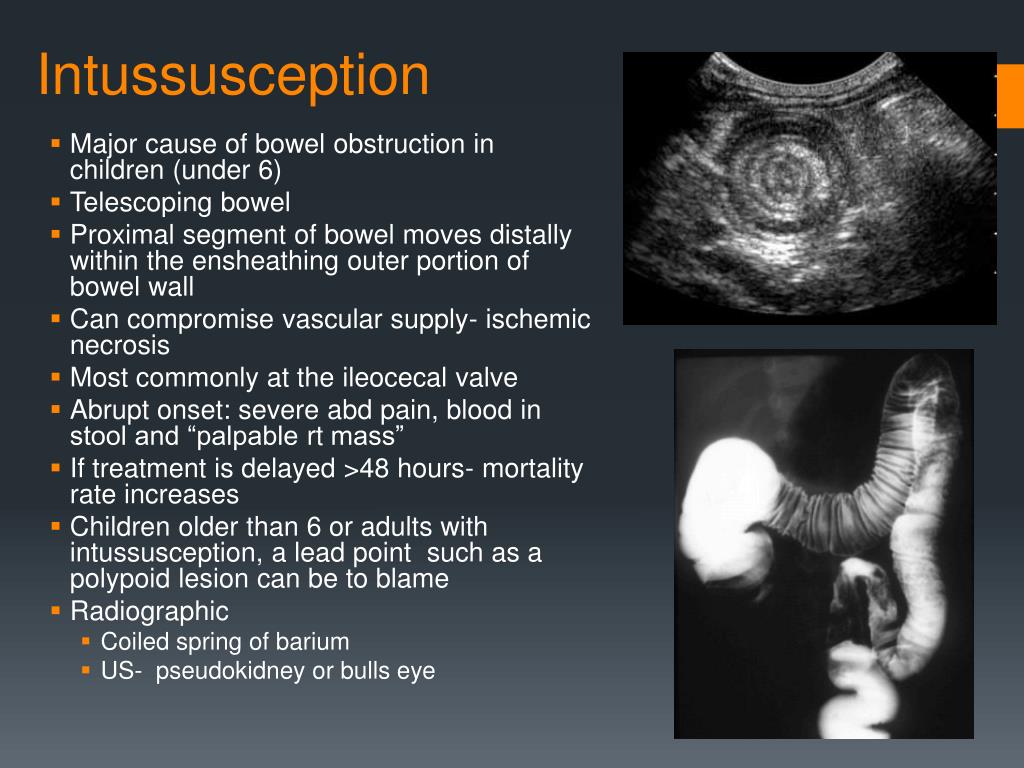 PPT Ch. 5 DMI 56 Gastrointestinal System PowerPoint Presentation
