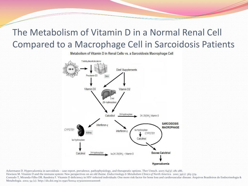 PPT Sarcoidosis & Vitamin D PowerPoint Presentation, free download