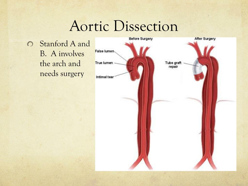 PPT Differential Diagnosis of Chest Pain PowerPoint Presentation