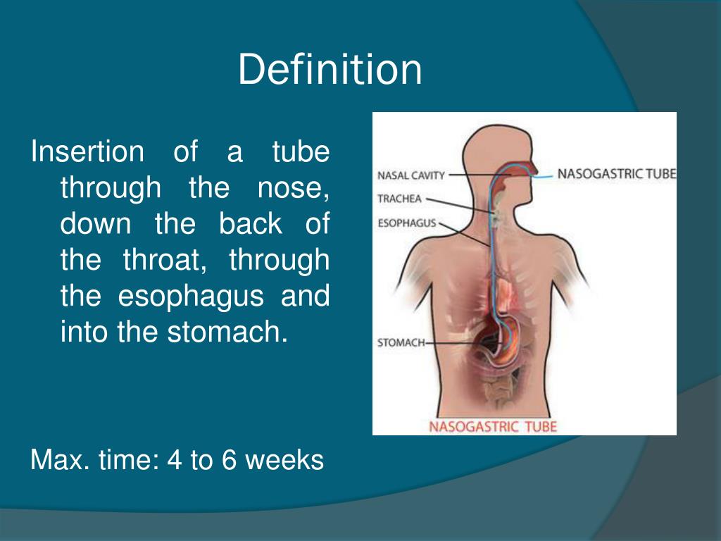 PPT Nasogastric tube insertion PowerPoint Presentation, free download