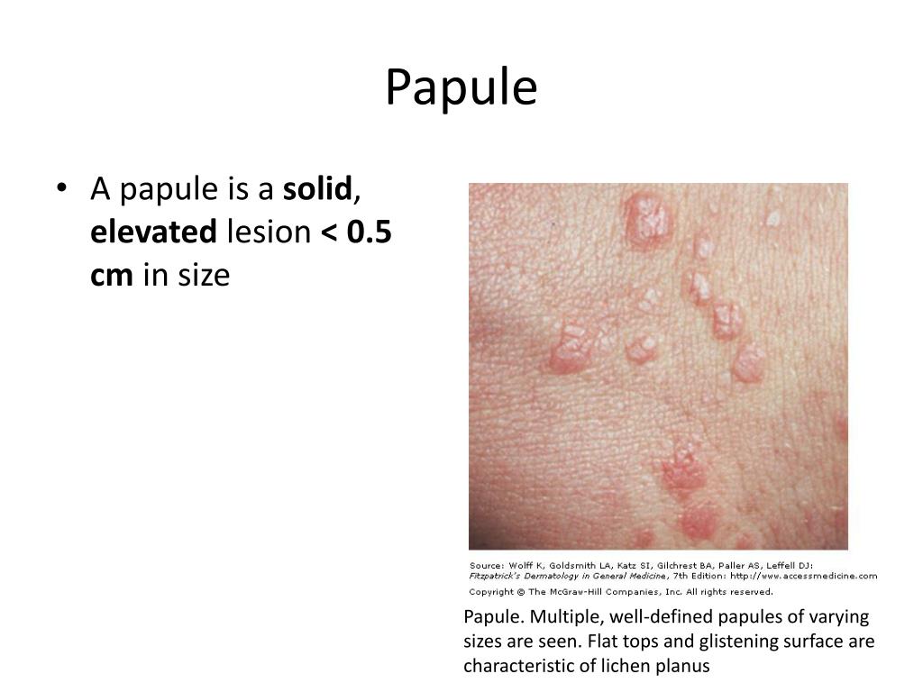 PPT Dermatological History and Examination PowerPoint Presentation