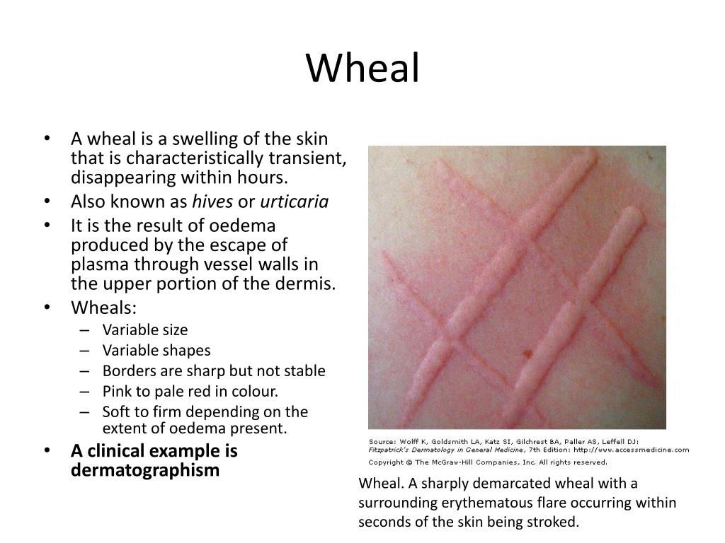 PPT Dermatological History and Examination PowerPoint Presentation