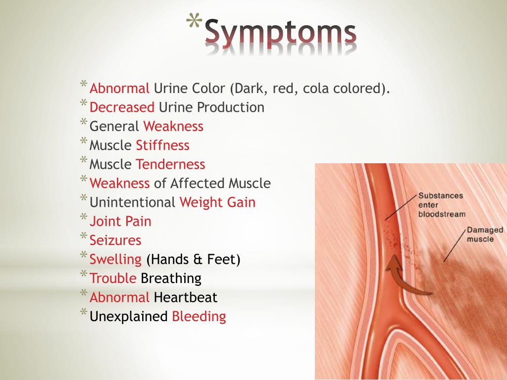 PPT Rhabdomyolysis PowerPoint Presentation, free