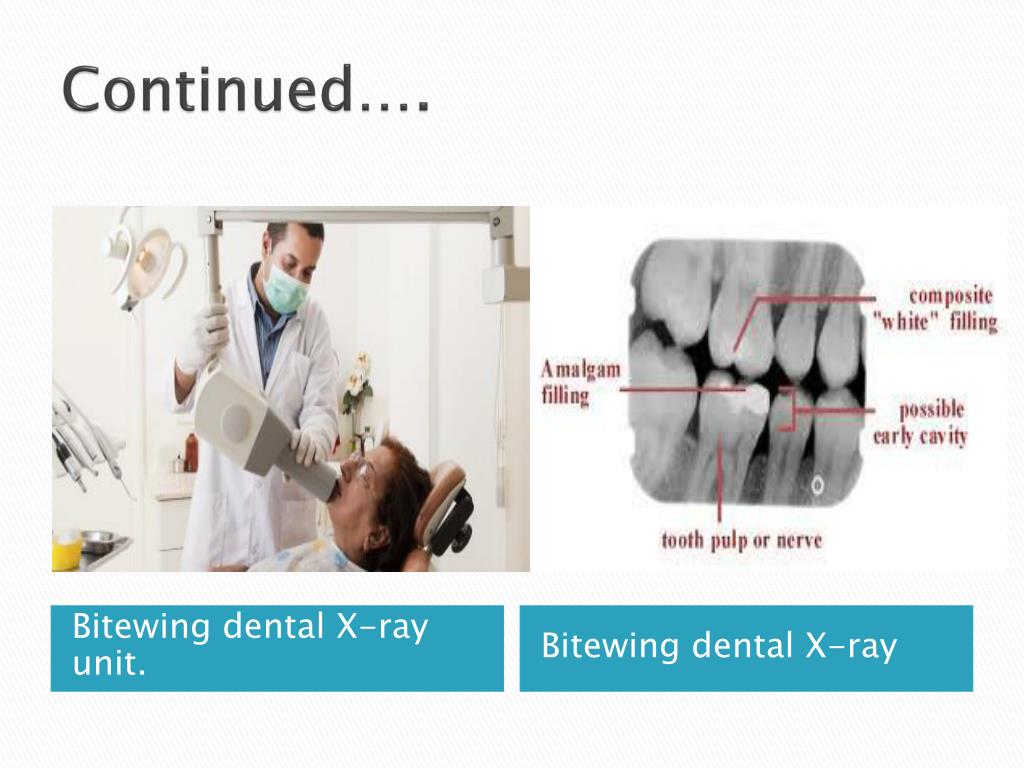 PPT DENTAL RADIOGRAPH. PowerPoint Presentation, free download ID