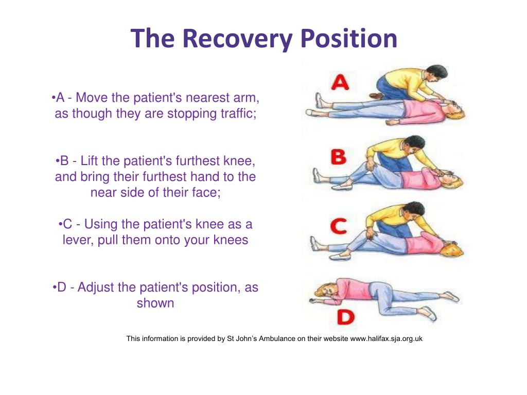 PPT EPILEPSY PowerPoint Presentation, free download ID2340489