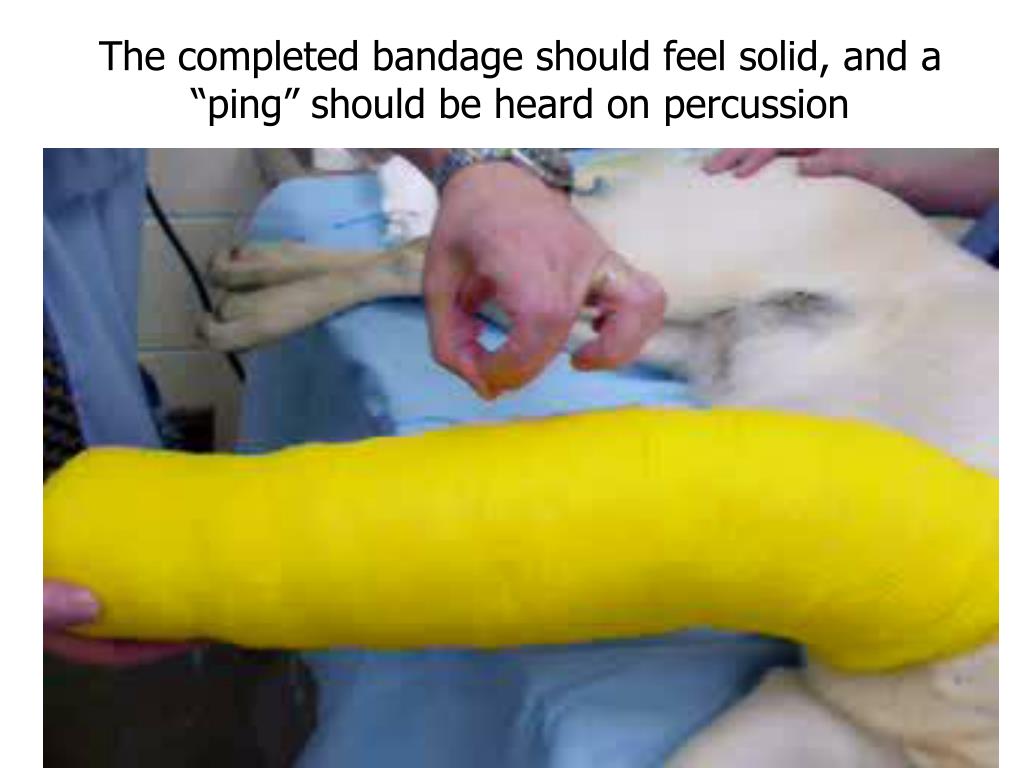 PPT Bandage Types PowerPoint Presentation, free download ID2342735