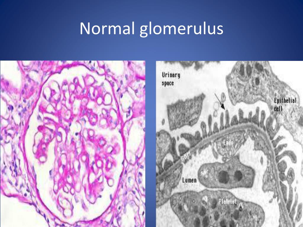 PPT Normal glomerulus PowerPoint Presentation, free download ID2346911