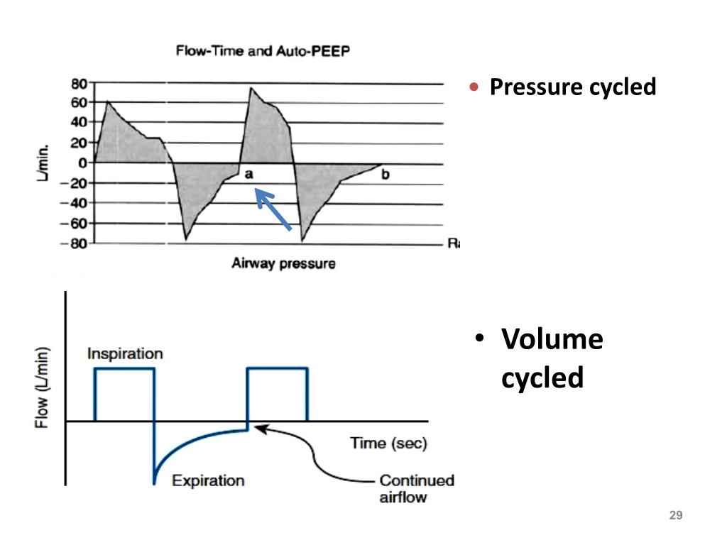 PPT Principles of Mechanical ventilation PowerPoint Presentation