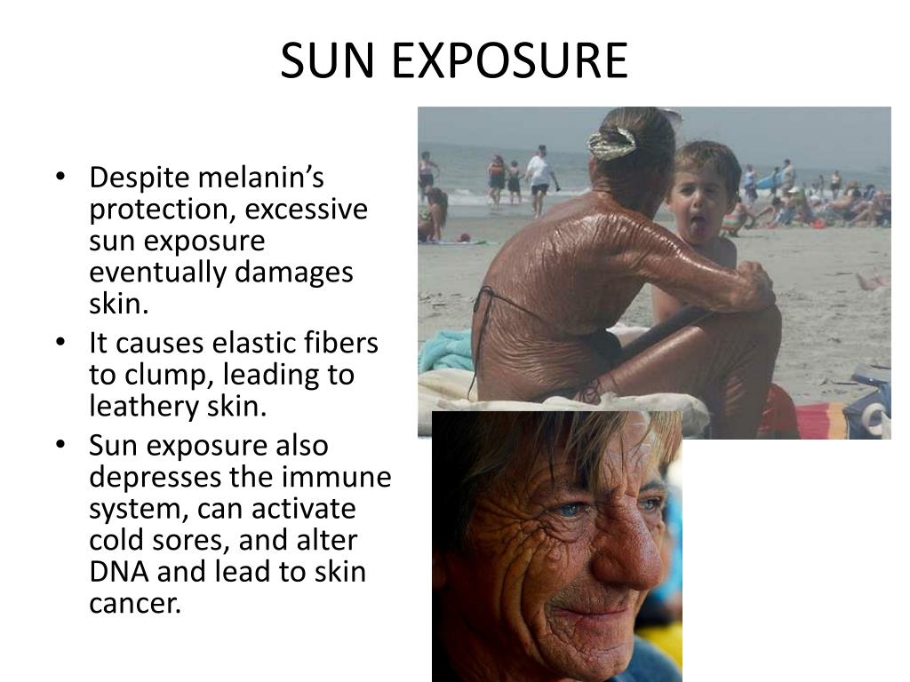 PPT SKIN AND BODY MEMBRANES INTEGUMENTARY SYSTEM PowerPoint