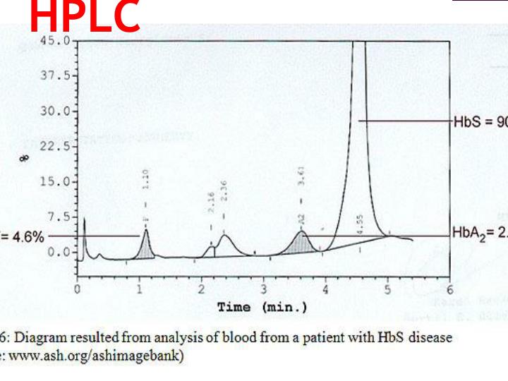 PPT Hemoglobin Electrophoresis PowerPoint Presentation ID2372418