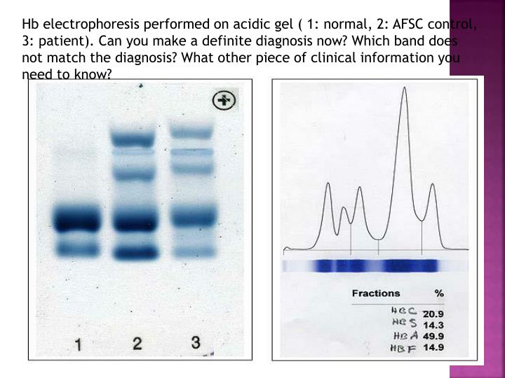 PPT Hemoglobin Electrophoresis PowerPoint Presentation ID2372418