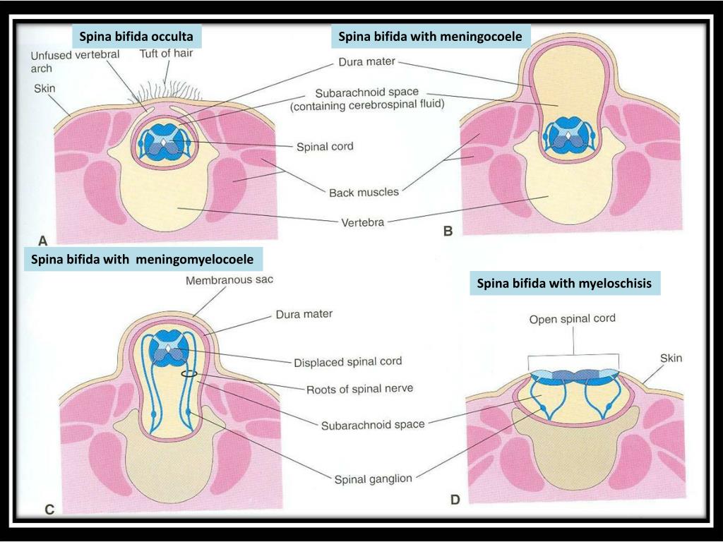 PPT DEVELOPMENT OF VERTEBRAL COLUMN & SPINAL CORD PowerPoint