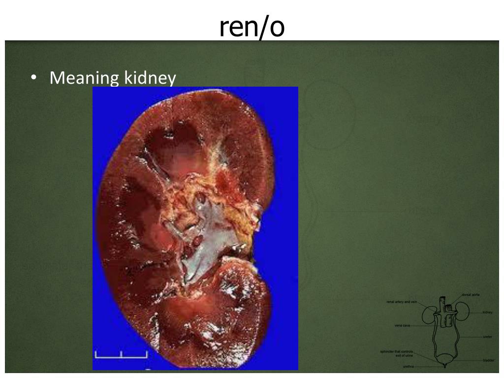 PPT The Urinary System PowerPoint Presentation, free download ID